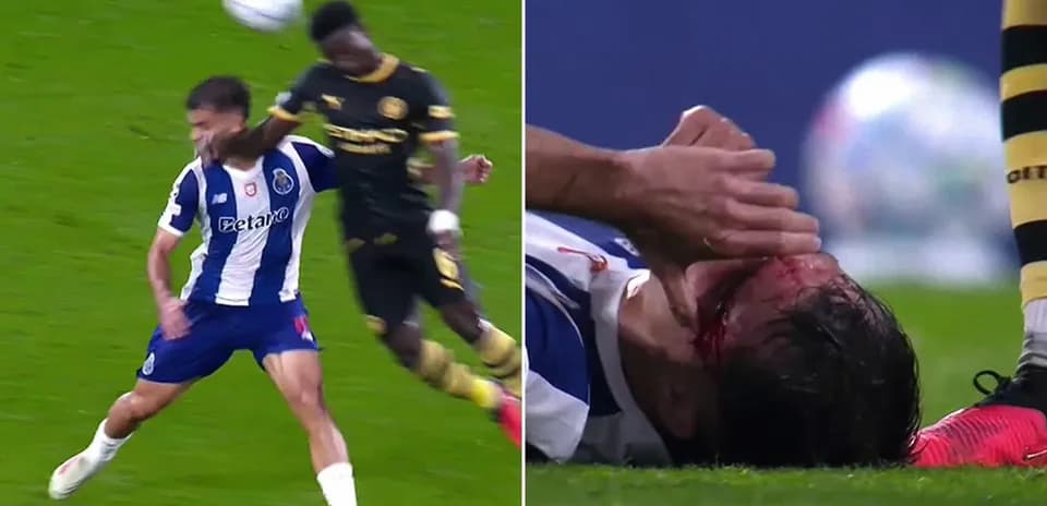 Jugador de Porto caído tras un choque en el partido