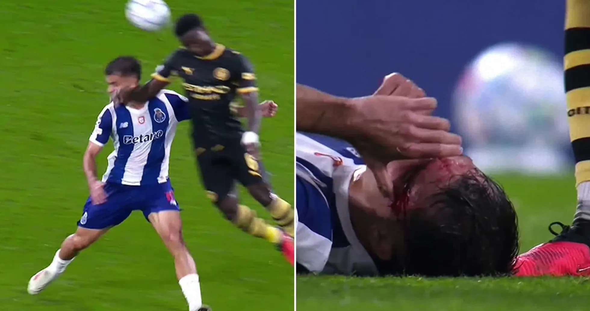 Jugador de Porto caído tras un choque en el partido Jugador de Porto caído tras un choque en el partido